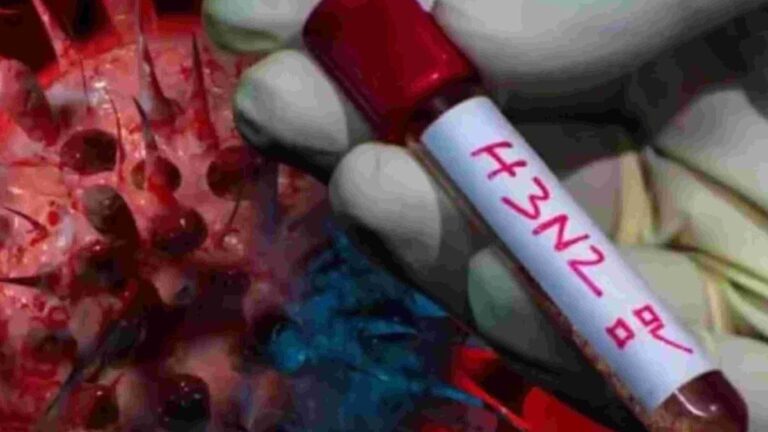 Murió el primer paciente de Argentina por súper gripe H3N2: cuáles son los síntomas