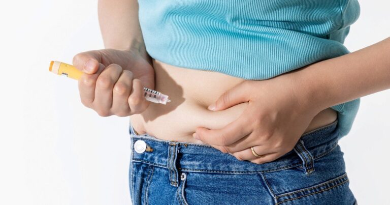 Procedimiento endoscópico para tratamiento de obesidad